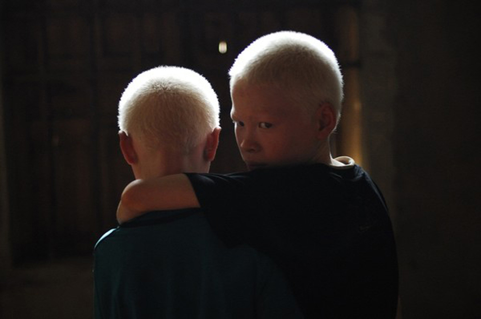 Vietnamese Photographer Cuong Do Manh Documents Albino Twins – Kana Kukui